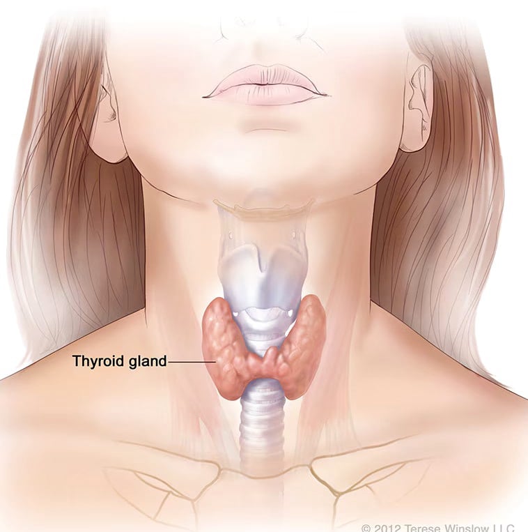 Hypothyroidism